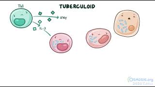 Mycobacterium Leprae  Leprosy  Osmosis [upl. by Rip]