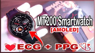 Top 5 Best Smartwatch With ECG [upl. by Assennav]