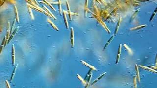 Diatoms [upl. by Latsirc]