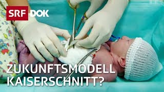 Kaiserschnitt  Die Geburt der Zukunft  Doku  SRF Dok [upl. by Dee]