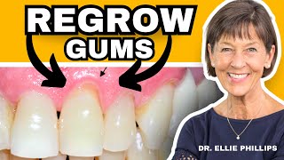 How To REGROW Receding Gums FIX Gum Recession At Home [upl. by Thilda170]