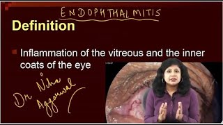 Endophthalmitis  Dr Niha Aggarwal [upl. by Ytisahc]