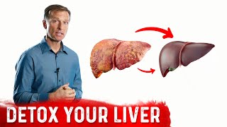 A Surprising Way To Cleanse Fatty Liver – Dr Berg On Liver Detoxification [upl. by Assehc]