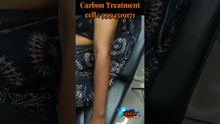 carbon laser treatment for skin whitening carbon laser benefits carbon laser before and after [upl. by Aillimat]