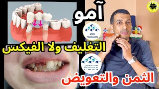 كيفاش نغلف نفيكسي سناني امو تضامن امو الشامل او نتعوض الضمان الاجتماعي AMO TADAMON AMO CHAMIL CNSS [upl. by Clothilde]