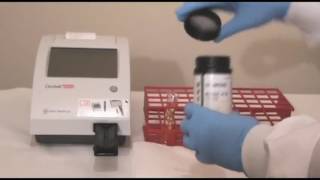 YouTube Urinalysis Clinitek Status [upl. by Aleck]