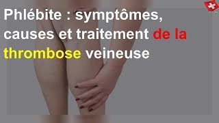 Phlébite  symptômes causes et traitement de la thrombose veineuse [upl. by Yneffit]