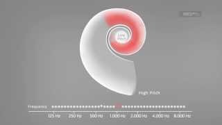 Sound Stimulates the Cochlea  MEDEL [upl. by Irem]