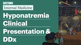 Hyponatremia Clinical Presentation amp DDx Internal Medicine  Sketchy Medical [upl. by Ardnal]