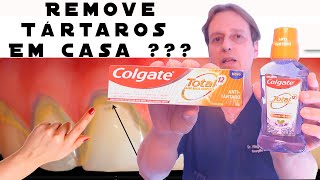 O Colgate Total 12 AntiTártaro Consegue Tirar Tártaros dos Dentes em Casa  Resenha [upl. by Akialam]