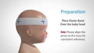 Using our Craniometer to Measure and Monitor Flat Head Syndrome [upl. by Keelin969]