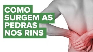 Como se forma o cálculo renal ou pedra nos rins  Educar para Prevenir Fundação PróRim [upl. by Icnan]