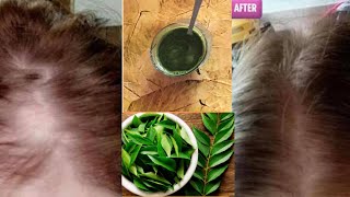 7 Days Hair Miracle Curry Leaves Magic Hair Growth Serum [upl. by Ervin]