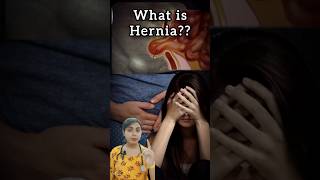 What is HERNIA😧 Hernia Part 2 new doctor health healthtips hernia shorts viral [upl. by Ahsien]