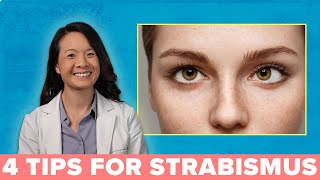 4 Great Ways to Treat Your Strabismus [upl. by Naillil]