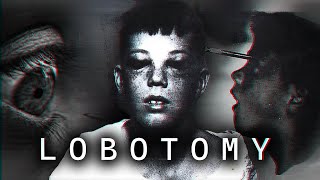 The Lobotomy Darkest Surgery In History [upl. by Leschen70]