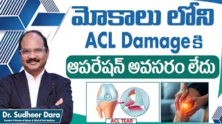 When Is Sugrey Necessary for ACL Injury  ACL Tear in Telugu  ACL Tear Treatment  Epione [upl. by Eboh]