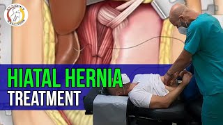 Hiatal Hernia Treatment  Synergy Wellness Chiropractic amp Physical Therapy PLLC [upl. by Nellak]