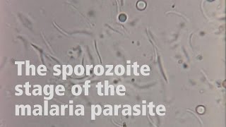 Photini Sinnis on malaria parasite infection [upl. by Aduhey]