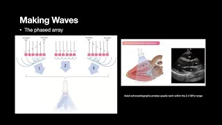 The Physics of echocardiography How I learned to love AS [upl. by Norehs]