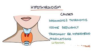 Hypothyroidism and Hashimotos Thyroiditis Visual Explanation for Students [upl. by Assiron183]