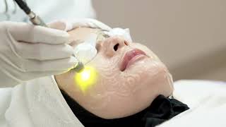 PERAWATAN DUAL YELLOW LASER DI NATASHA SKIN CLINIC CENTER [upl. by Adnarom]