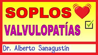 Cómo Memorizar los Soplos y las Valvulopatías Cardíacas [upl. by Airelav]