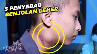 Penyebab Benjolan di Leher  5 Hal yang Perlu Kamu Tahu Sebelum Terlambat [upl. by Atinav]