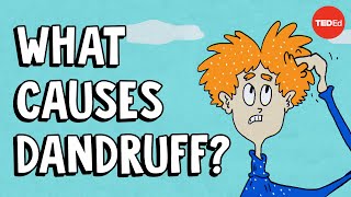 What causes dandruff and how do you get rid of it  Thomas L Dawson [upl. by Vesta]