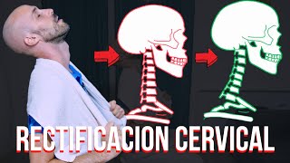 El MEJOR ejercicio para la RECTIFICACION CERVICAL [upl. by Aidahs74]