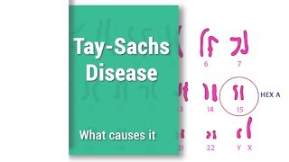 TaySachs Disease  THD  Hex A  Hexosaminidase A [upl. by Ettennor]