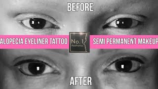 Eyeliner Tattoo  Semi Permanent Makeup  ALOPECIA [upl. by Ahsytal]