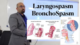 lec LaryngoSpasm amp Bronchospasm [upl. by Bethanne]