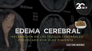 Edema e inflamación en tejido cerebral provocado por oler pimienta Caso Thaís Medeiros  MSP [upl. by Jerrilyn]