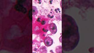 Brain eating amoeba 😱 scaryfacts facts factsyouneedtoknow factshorts amoeba fyp brainfacts [upl. by O'Carroll]