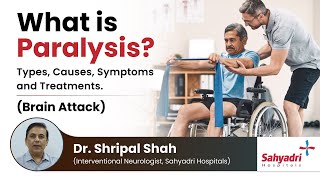 Things you should know about paralysis  Brain Stroke Brain Attack  Dr Shripal Shah [upl. by Meador]