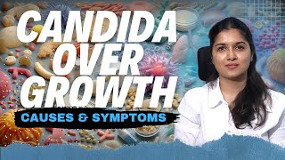 Candida Overgrowth Causes Risk Factors and How to Keep It in Check  Dt Vineesha Reddy [upl. by Wolf]