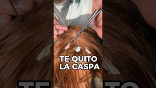 TE QUITO LA CASPA asmr shorts asmrvideo comedia [upl. by Tracie]