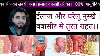 hemorrhoidspilesवबासिर का 100आयुर्वेदिक इलाज।💯💯helthHemoroyids [upl. by Atiram]