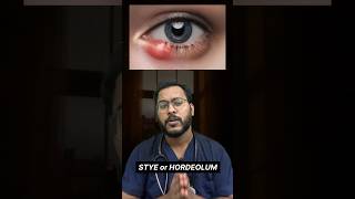 STYE  HORDEOLUM stye hordeolum eyes eyehealth eyeinfection health fitness medicine doctor [upl. by Ferris]