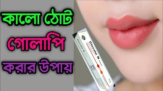 বগলের কালো দাগ দূর করার প্রাকৃতিক উপায়bogoler dag dur korar tipsbologer dag uthar upay [upl. by Janaye]