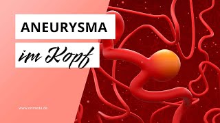 Aneurysma im Kopf Diese Symptome sind Warnzeichen [upl. by Eylhsa]