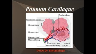 Poumon Cardiaque Oedeme aigu du poumon OAP Physiopathologie de linsuffisance cardiaque gauche [upl. by Aihsik]