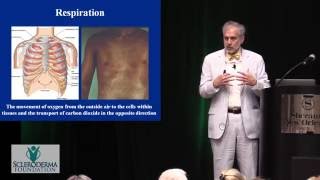 2016 New Orleans  Grand Lecture  quotScleroderma Lung Disease Why Am I So Short of Breathquot [upl. by Alac37]