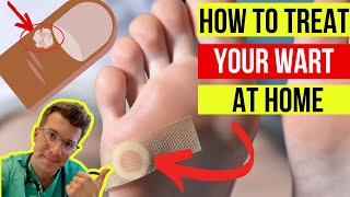 Doctor explains how to treat WARTS at home plus when to seek medical attention [upl. by Evante]