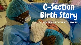 CSection Birth Story amp Recovery Experience 2 Weeks Postpartum [upl. by Odracer]