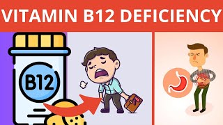 Vitamin B12 Deficiency Signs Youre Not Aware Of [upl. by Carmelita]