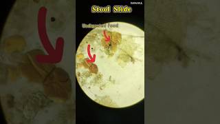 Stool examination shortsvideo youtube [upl. by Annirtak]