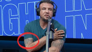 What Happened To Frank Mir’s Right Arm [upl. by Bartlett]