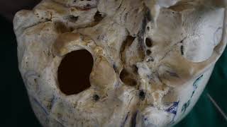 Osteology of Norma Basalis part 4 [upl. by Henriette]